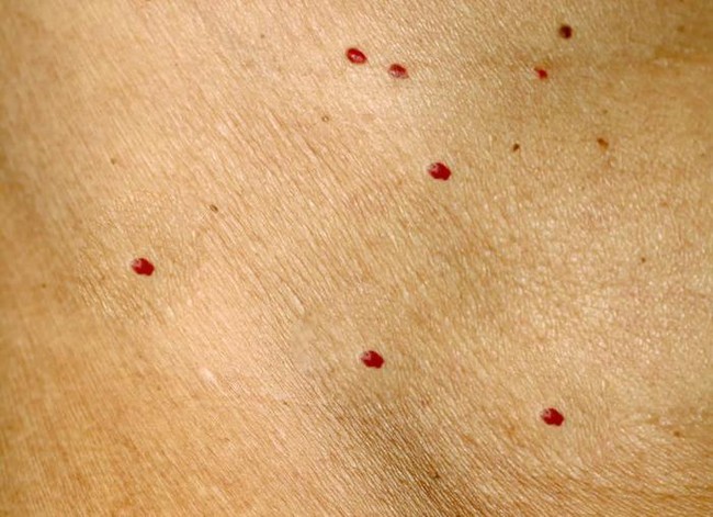 Từ ngứa da đến ung thư giai đoạn cuối, chỉ 3 tháng, có 4 dấu hiệu trên da, hãy cẩn thận khối u đã xâm lấn - Ảnh 4.